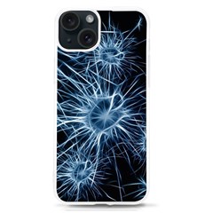 Neurons Brain Cells Structure Iphone 15 Tpu Uv Print Case